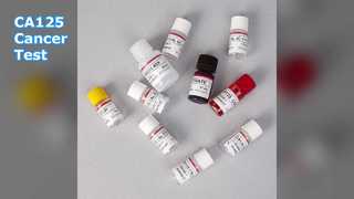 Test ELISA CA125 do monitorowania raka