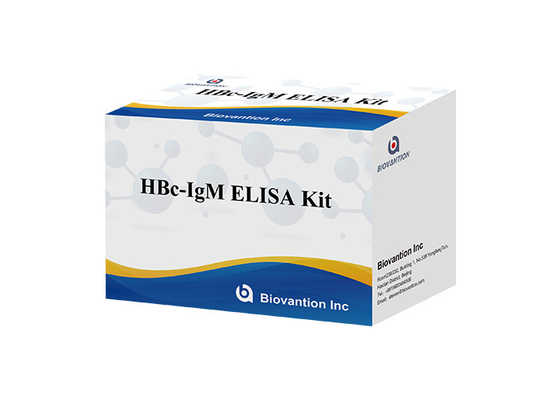 Zestaw testowy ISO13485 HBc IgM Test przeciwciał Igm przeciwko wirusowemu zapaleniu wątroby typu B