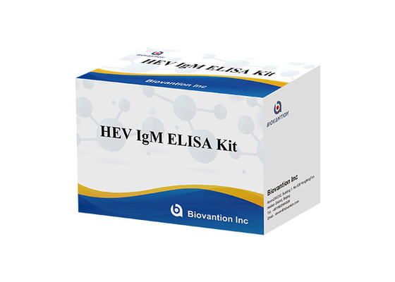 Zestaw testowy HEV IgM Elisa, surowica vs osocze do wykrywania przeciwciał