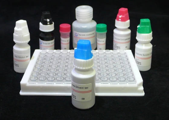 ISO13485 HIV Ab Ag Test Hiv 4th Generation Assay Zestaw ELISA 60 minut