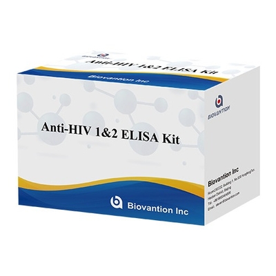 HIV Elisa Test Kit 18-miesięczny okres ważności Test Elisa o wysokiej wrażliwości i specyficzności