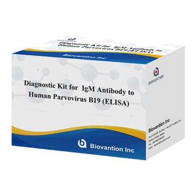 Zestaw diagnostyczny dla ludzkiego parwovirusu B19 IgM antyciała Elisa z 96T