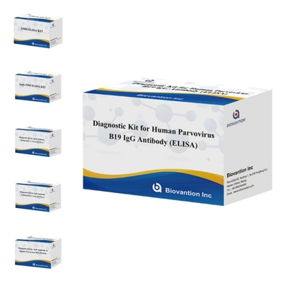 Zestaw diagnostyczny dla ludzkiego parwovirusu B19 IgM antyciała Elisa z 96T