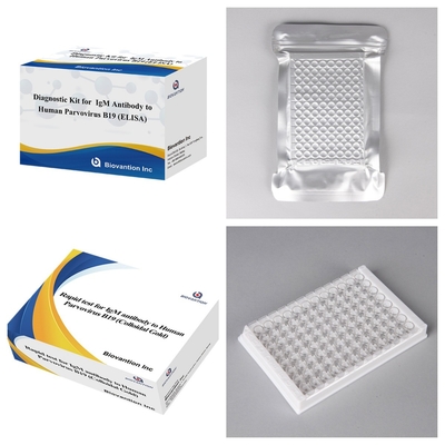 Zestaw diagnostyczny dla ludzkiego parwovirusu B19 IgM antyciała Elisa z 96T