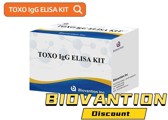 TOXO Ig G Sensory and Specific Elisa Test Kit do monitorowania chorób