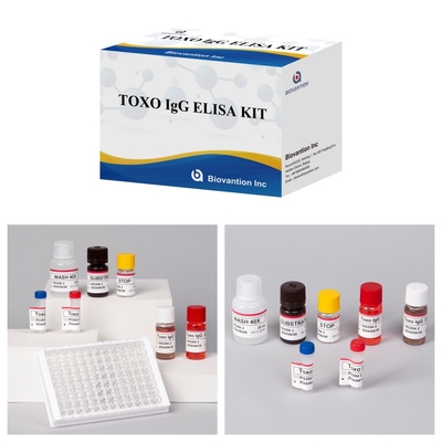 TOXO Ig G Sensory and Specific Elisa Test Kit do monitorowania chorób