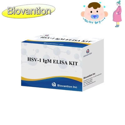 Zestaw badawczy ELISA z pochodnią HSV 1 IgM Wysoki reagent diagnostyczny IVD