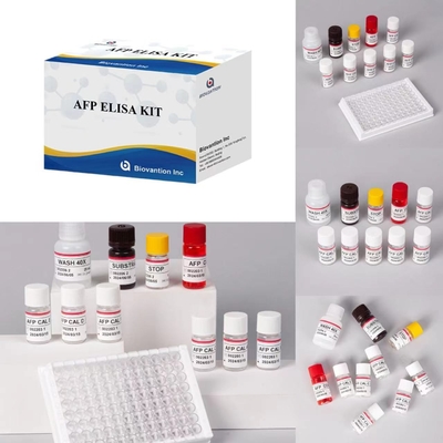 AFP Alfa Fetoprotein Elisa Test Kit Produkty związane z enzymem Krótki czas transportu