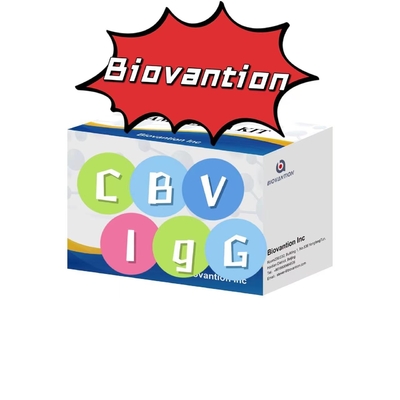 Zestaw diagnostyczny dla przeciwciał CBV-IgG zestaw badawczy ELISA zestaw badawczy serum