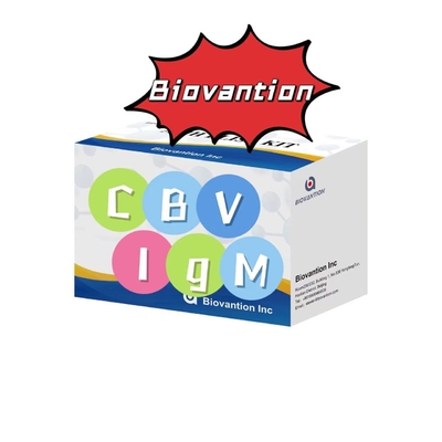 Zestaw diagnostyczny dla przeciwciał IgM do CBV zestaw testowy Elisa 50 μL serum Diagnostyka medyczna