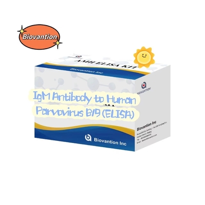 Przeciwciało do ludzkiego parworyusu B19 IgM ELISA Test Kit Diagnostyczny Kit
