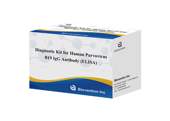 Przeciwciało do ludzkiego parworyusu B19 IgM ELISA Test Kit Diagnostyczny Kit
