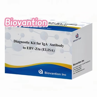 Zestaw diagnostyczny przeciwciał IgA do EBV-Zta ELISA TEST KIT Zestaw badawczy immunosorbent