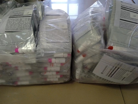 Epstein Barr EB-IgM antyciała szybki test kaseta serum szybkie testy profesjonalne