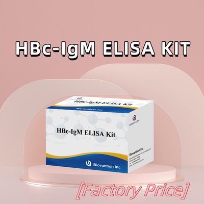 Wysokiej dokładności HBc IgM Antgen Diagnostic Reagent Test With Enzyme-Linked Immunosorbent Assay Test Kit