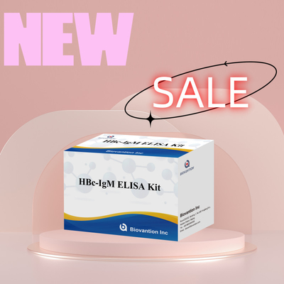 Wysokiej dokładności HBc IgM Antgen Diagnostic Reagent Test With Enzyme-Linked Immunosorbent Assay Test Kit