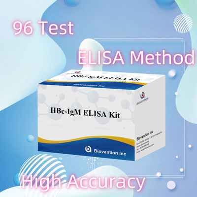Wysokiej dokładności HBc IgM Antgen Diagnostic Reagent Test With Enzyme-Linked Immunosorbent Assay Test Kit