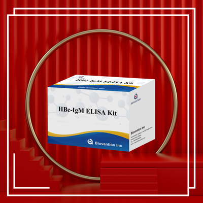 Wysokiej dokładności HBc IgM Antgen Diagnostic Reagent Test With Enzyme-Linked Immunosorbent Assay Test Kit