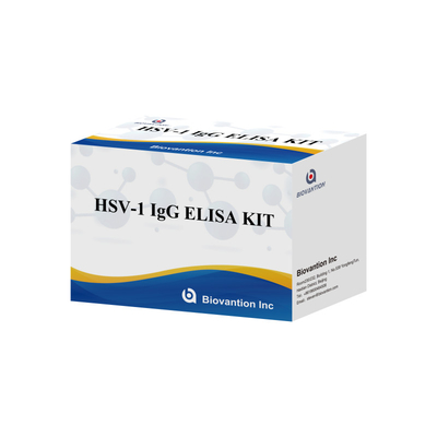 Wysokiej wrażliwości zestaw do badania immunologicznej HSV-1 IgG do wykrywania serologicznego Typ próbki osocza