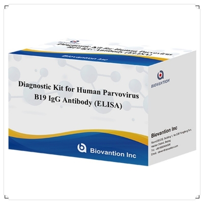 Zestaw testowy ELISA B19 dla ludzkiego antyciała IgM przeciwko parworyusowi B19 z 96T