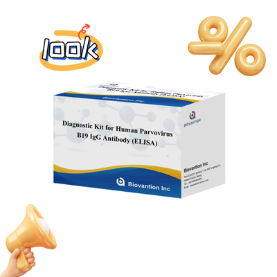 Zestaw testowy ELISA B19 dla ludzkiego antyciała IgM przeciwko parworyusowi B19 z 96T