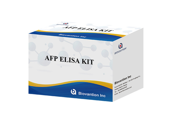 AFP Alfa Fetoprotein Elisa Test Kit Produkty związane z enzymem Krótki czas transportu
