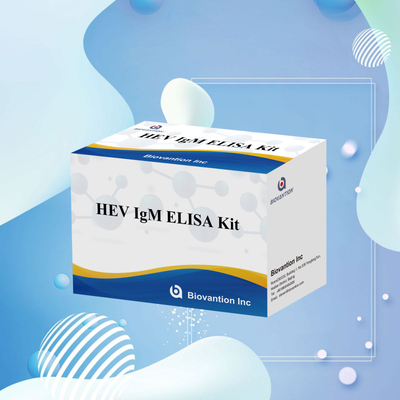 Dokładny i wrażliwy zestaw badawczy HEV-IgM Elisa do precyzyjnego wykrywania i analizy