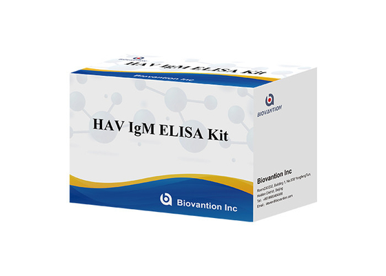 Przeciwciała na wirus zapalenia wątroby typu A HAV IgM In Vitro Enzymy Immunoassay Serum / plazma