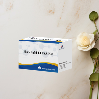 Zestaw HAV IgM ELISA Wysoka wrażliwość Wirus wirusowy wirusowy wirusowy wirusowy wirusowy wirusowy wirusowy wirusowy wirusowy wirusowy wirusowy wirusowy wirusowy wirusowy wirusowy wirusowy wirusowy wirusowy wirusowy wirusowy wirusowy wirusowy wirusowy wirusowy wirusowy wirusowy wirusowy wirusowy wirusowy wirusowy wirusowy wirusowy wirusowy wirusowy wirusowy wirusowy wirusowy wirusowy wirusowy wirusowy wirusowy wirusowy wirusowy wirusowy wirusowy wirusowy wirusowy wirusowy wirusowy wirusowy wirus