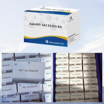 Szybki i łatwy zestaw badawczy HIV ELISA do szybkiego i wygodnego wykrywania choroby