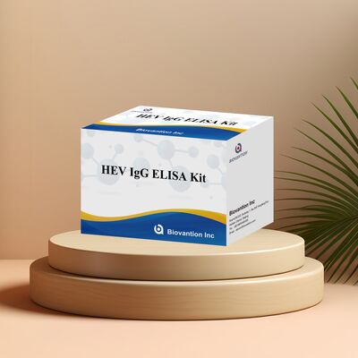 Zestaw badawczy HEV-IgG ELISA o wysokiej wrażliwości o rozmiarze 96T i okresie ważności 18 miesięcy do diagnostyki zapalenia wątroby E