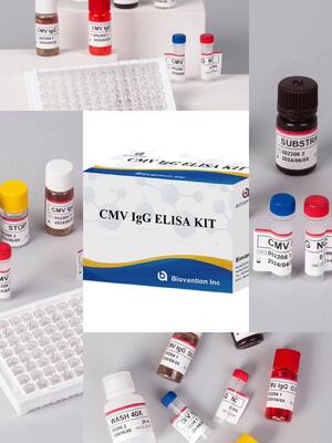 Laboratoryjne lub szpitalne zestawy testowe CMV IgG Elisa o wysokiej dokładności